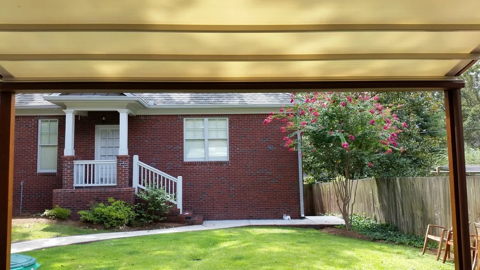 Residential project in Atlanta, Georgia by RetractableAwnings.com Inc. - Photo 7