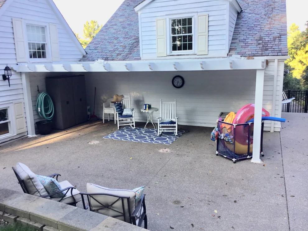 StruXure Outdoor - Adjustable Louvered Pergola for Patios by Adjustable Patio Covers, NE, LLC - Photo 21
