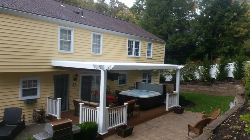 StruXure Outdoor - Adjustable Louvered Pergola for Patios by Adjustable Patio Covers, NE, LLC - Photo 13