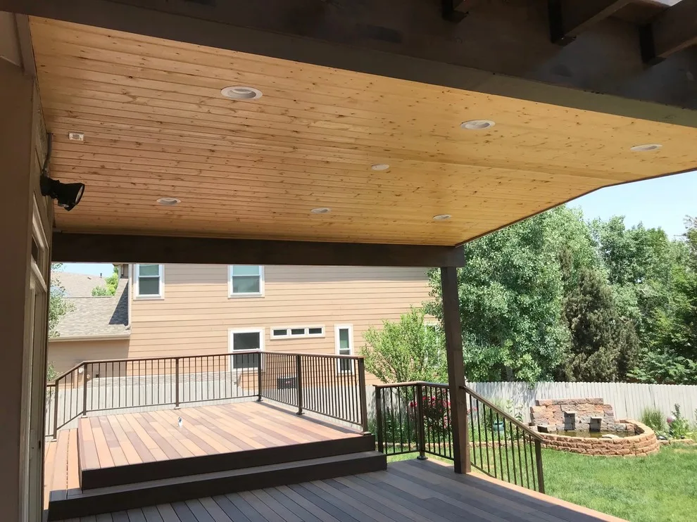 Westminster Patio Structure with Pergola and Deck by Integrity Building And Remodeling - Photo 3