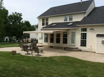 Retractable Awnings - Window Shades — Deck Building & Repair project by Northfield Fireplace & Grills