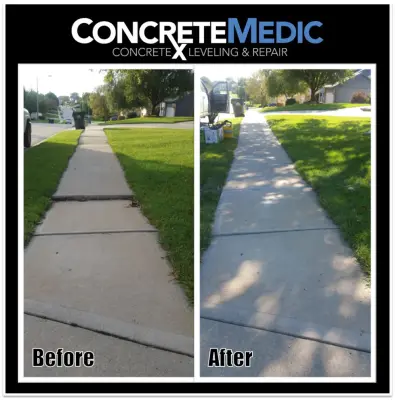 Omaha Concrete Sidewalk Trip Hazard Repair — Driveway Repair & Paving project by ConcreteMedic