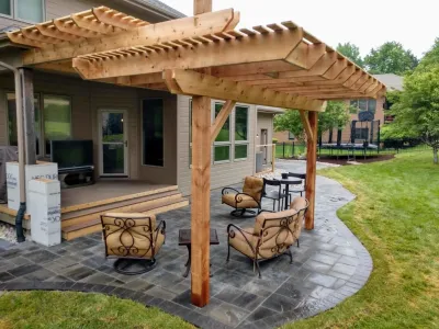 Patio/2 tier Pergola — Landscape Construction project by Radik Landscape Construction INC
