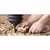 Direct Bury with Yellow Nut, 50 V 2-23/32" x 1-1/2", For Irrigation Systems and Low Voltage Lighting Splice Kit | KNG20210
